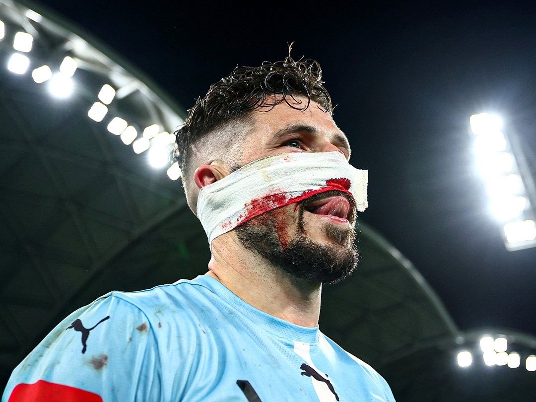 莱基在澳超决赛中面部受伤,不得不退出澳大利亚队大名单