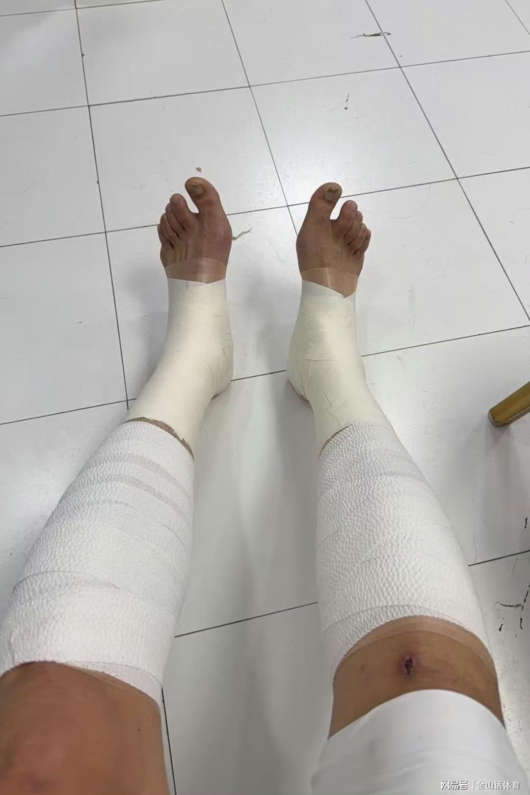 硬汉！32岁老将两腿全拉伤，缠满绷带打20分钟，媒体人:真是拼了